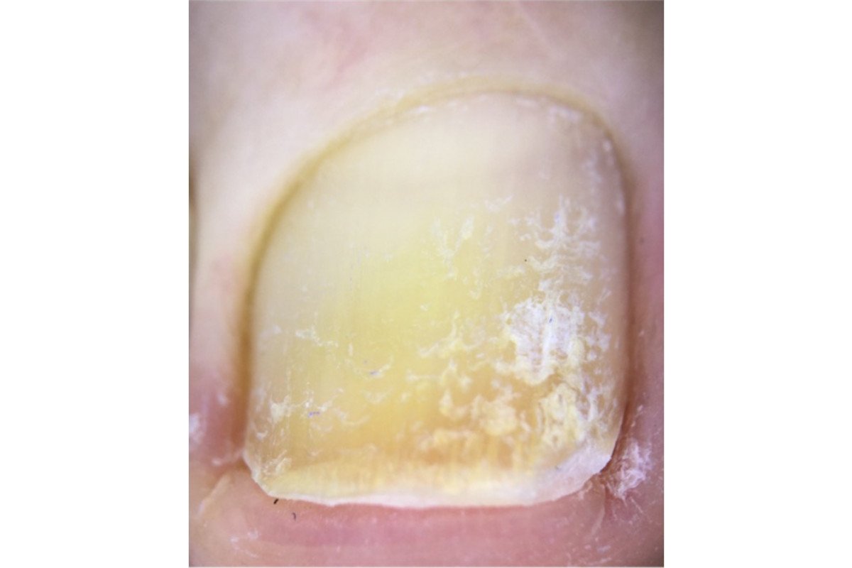 UNULA Blog escoger un esmalte