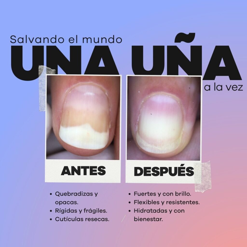 Unula producto-la-be 5